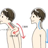 巻き肩と肩甲舌骨筋