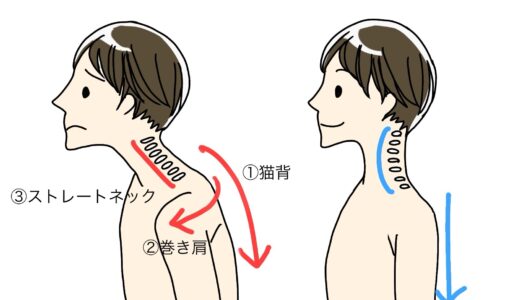 巻き肩と肩甲舌骨筋